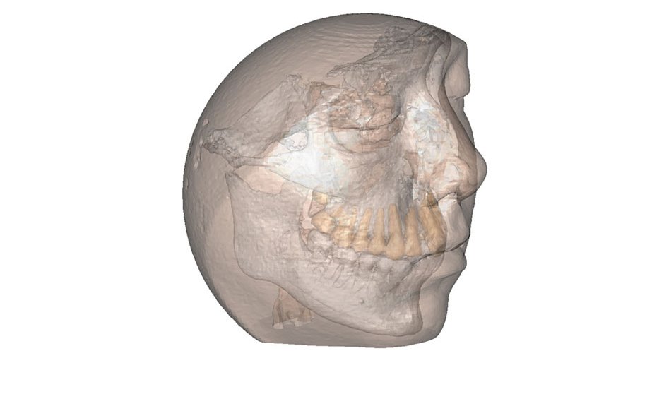 Η ζωή είναι 3D. Τώρα, είναι και η χειρουργική μόνο στο Metropolitan