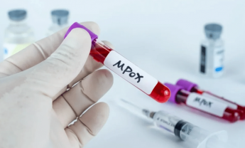 Συναγερμός στην Ευρώπη για την mpox – Σε εγρήγορση ο ΕΟΔΥ – Πως μεταδίδεται και ποιοι κινδυνεύουν!